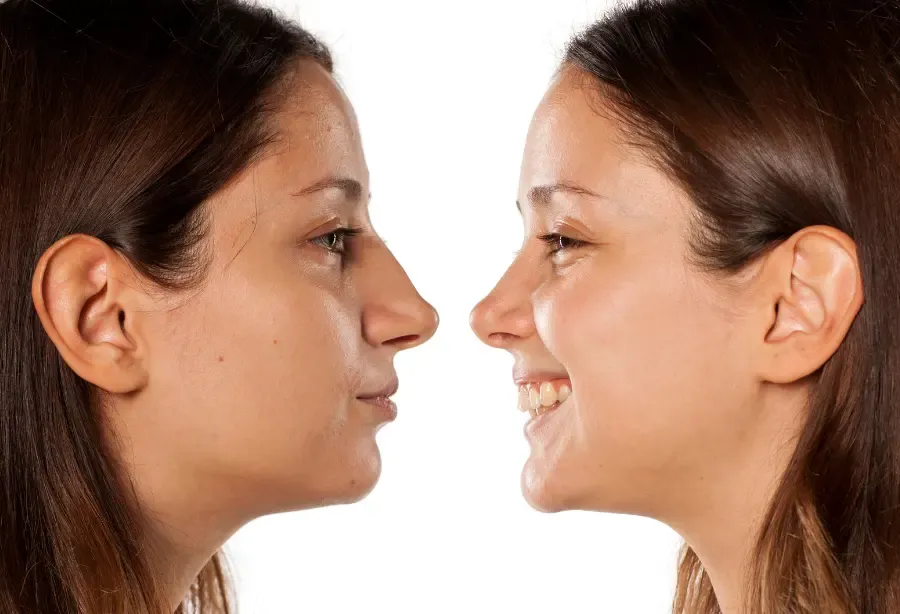 Natural lasting results