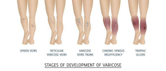 Vascular health